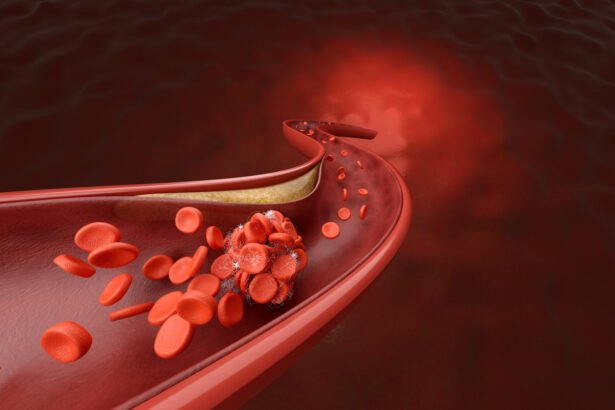 Nutricionistas norte-americanos descobriram por que o salmão ajuda a diminuir nível de colesterol ruim no sangue – iStock/G