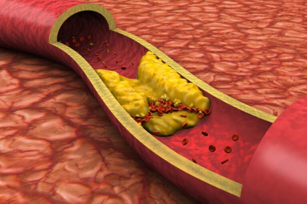 Saiba tudo sobre o colesterol e quais os impactos dele se os níveis estiverem elevados