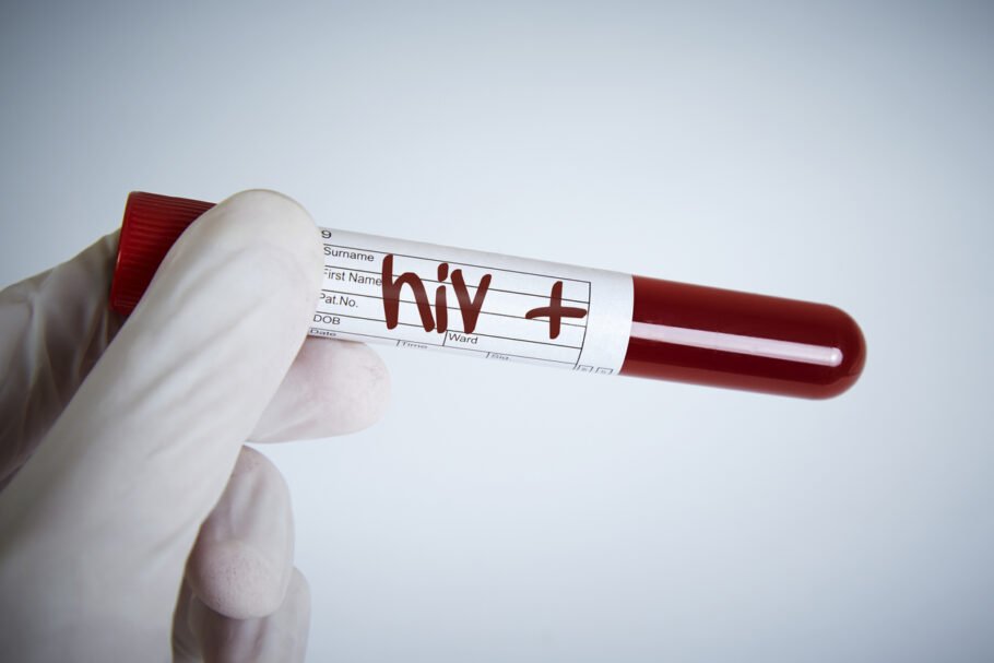 O HIV enfraquece a capacidade do organismo de combater infecções e doenças