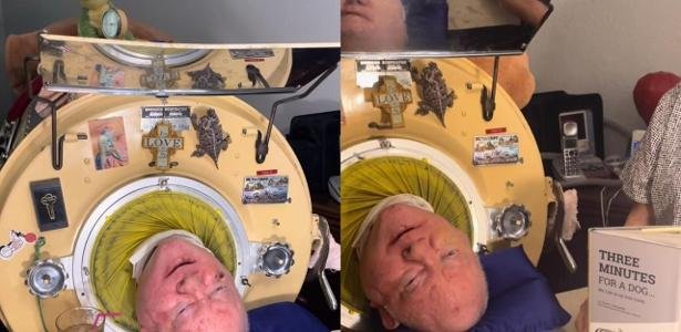 Homem que viveu com pulmão de ferro por 70 anos morre de covid