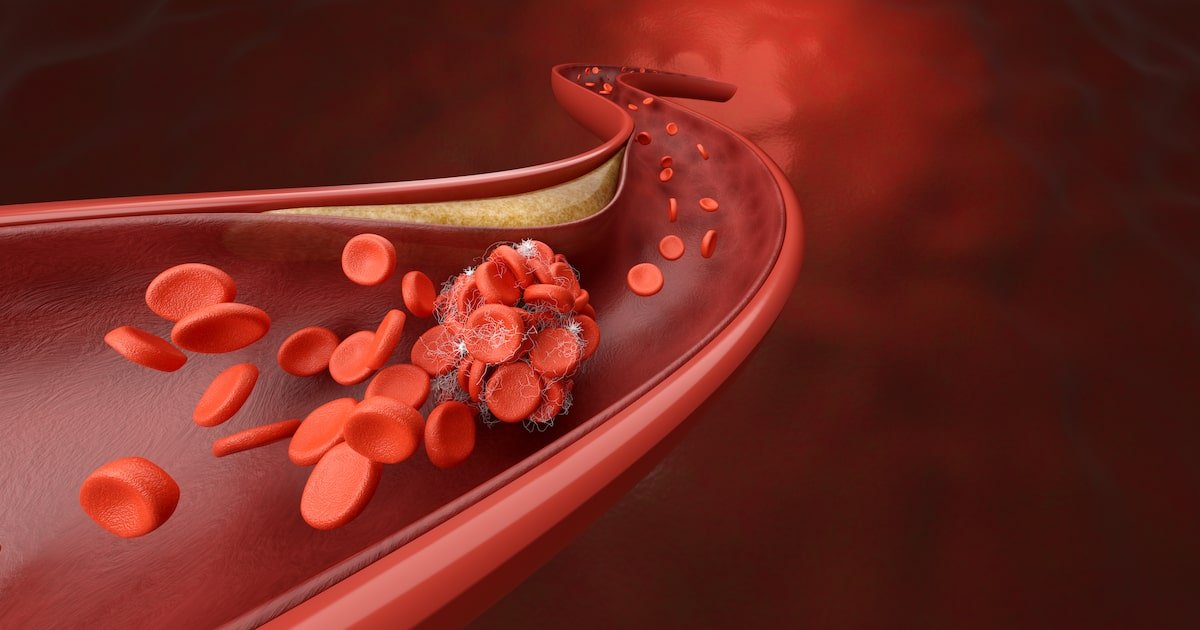 Colesterol alto: veja os riscos, sinais de alerta e como controlar