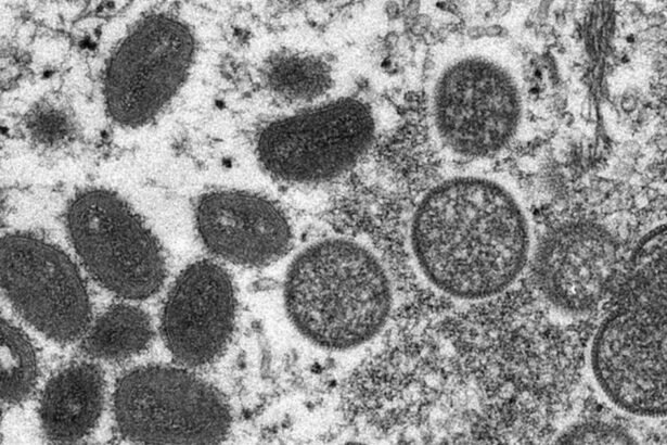 OMS alerta sobre nova cepa mais mortal da varíola dos macacos; entenda