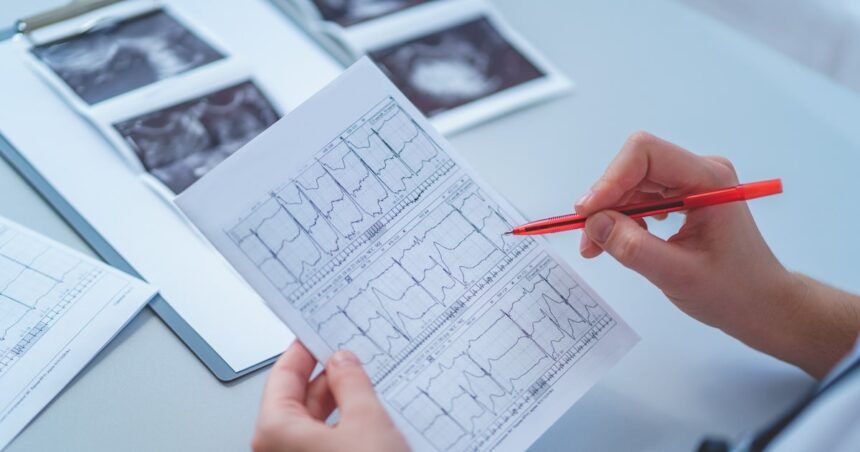 Eletrocardiograma de uso doméstico chega às farmácias; veja para quem é indicado e como utilizar